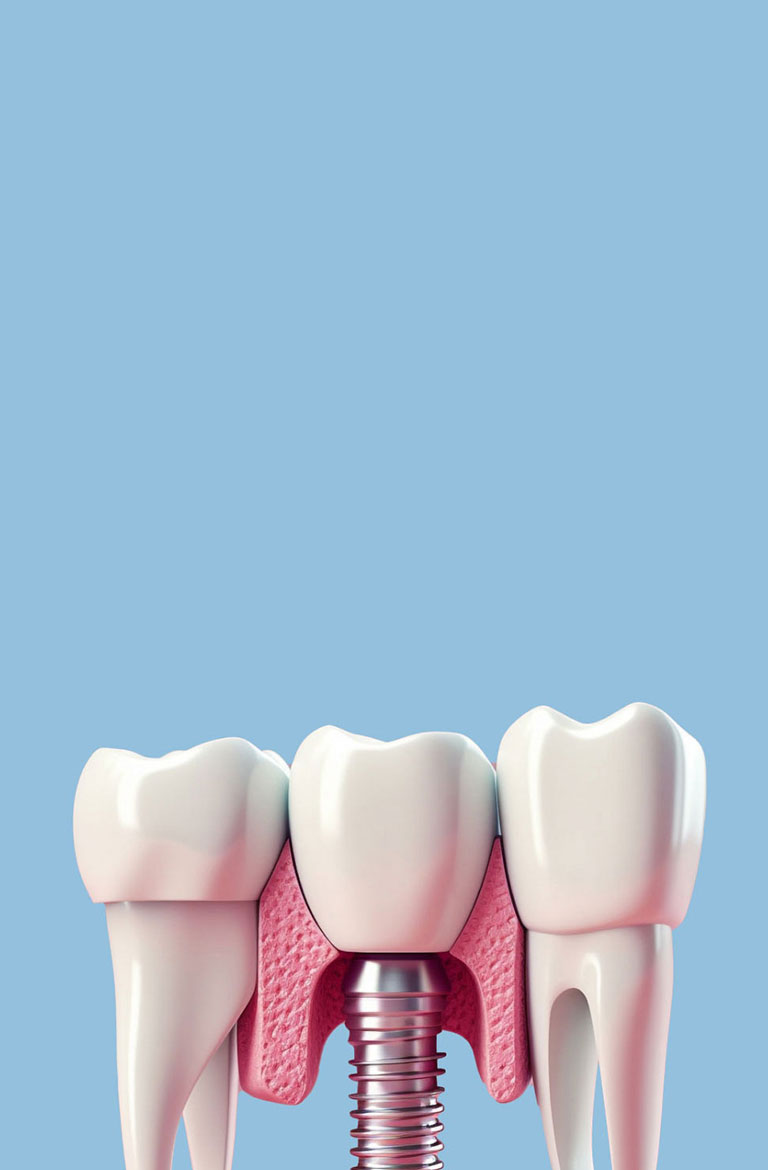 陶瓷烤瓷义齿
ODM/OEM/ 代工/贴牌